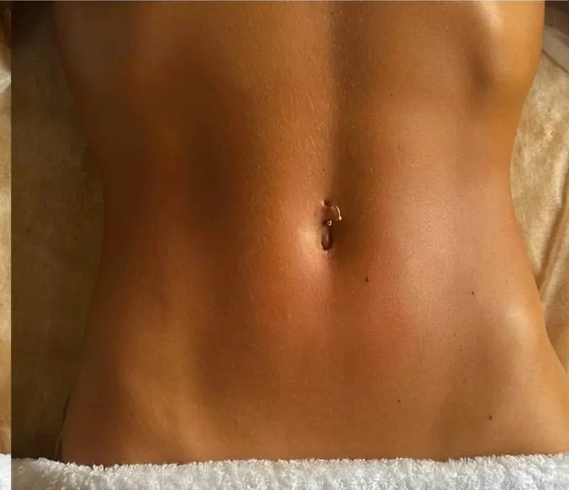 Abdomen after treatment
