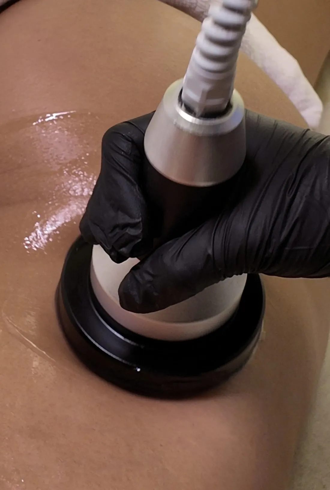 Cavitation