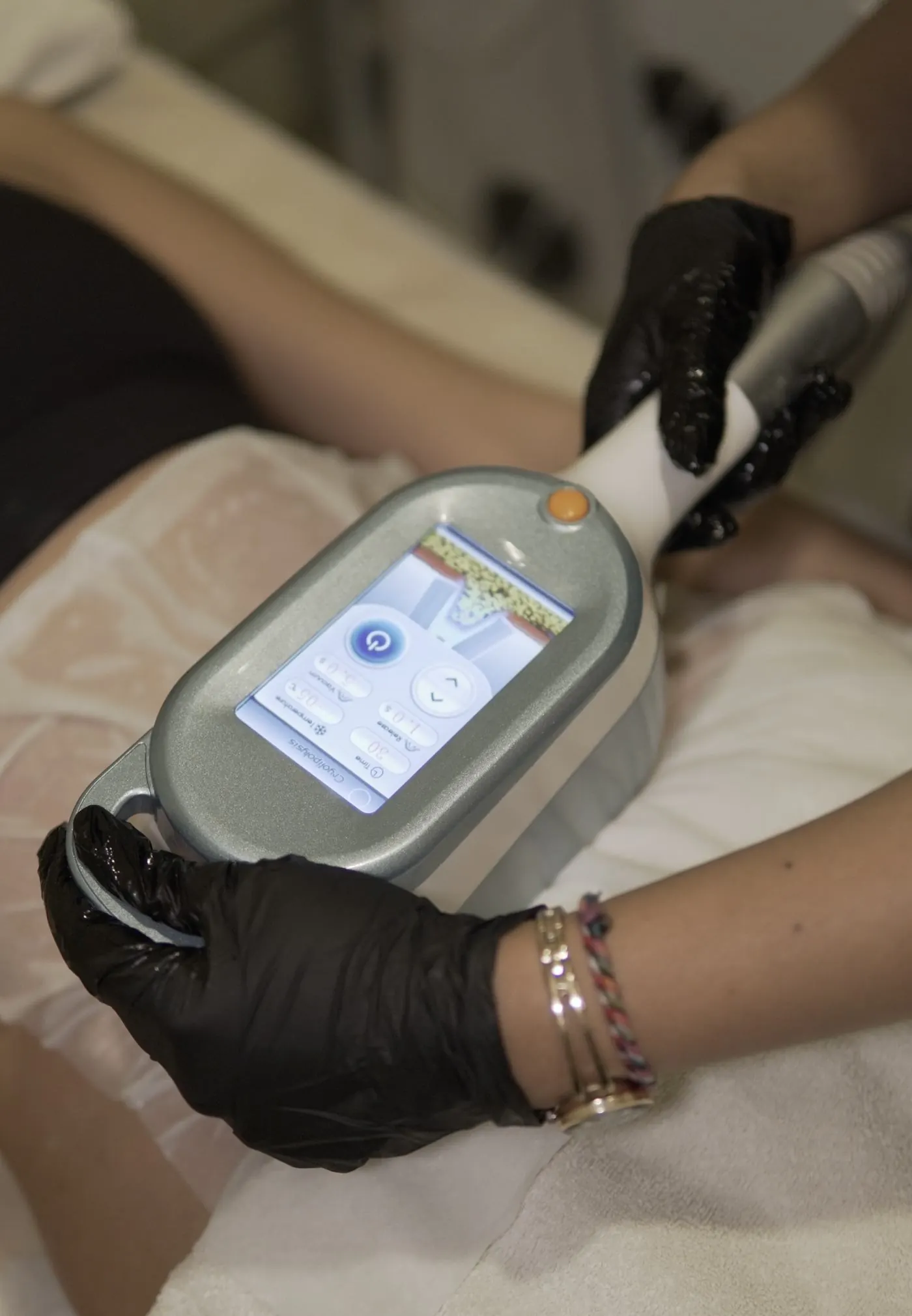Cryolipolysis