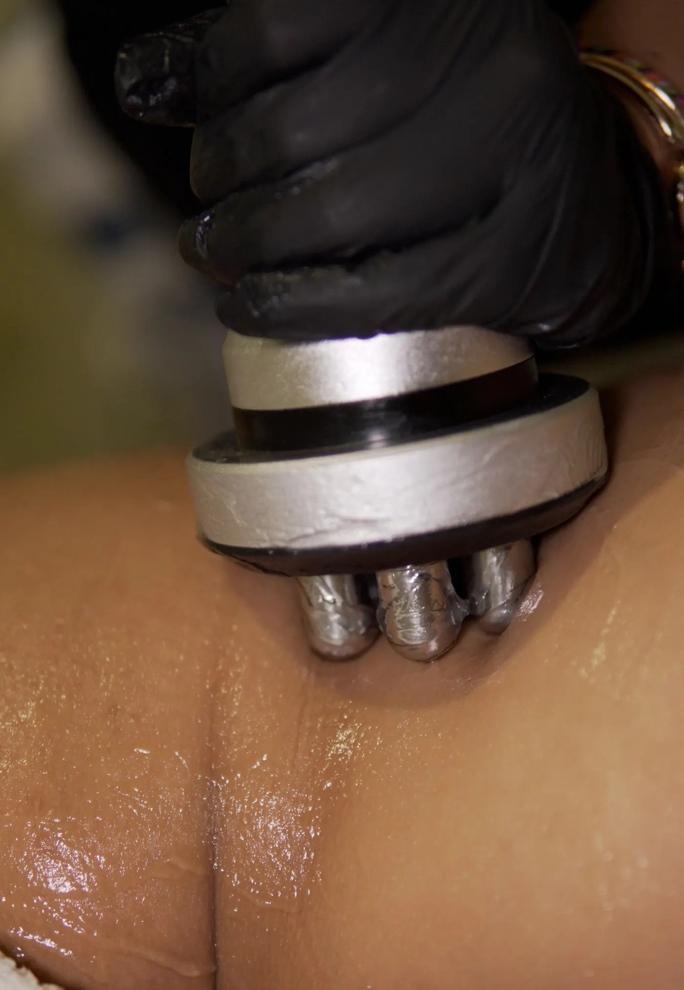 Radiofrequency
